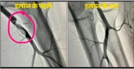 B. M. Shah Hospital :